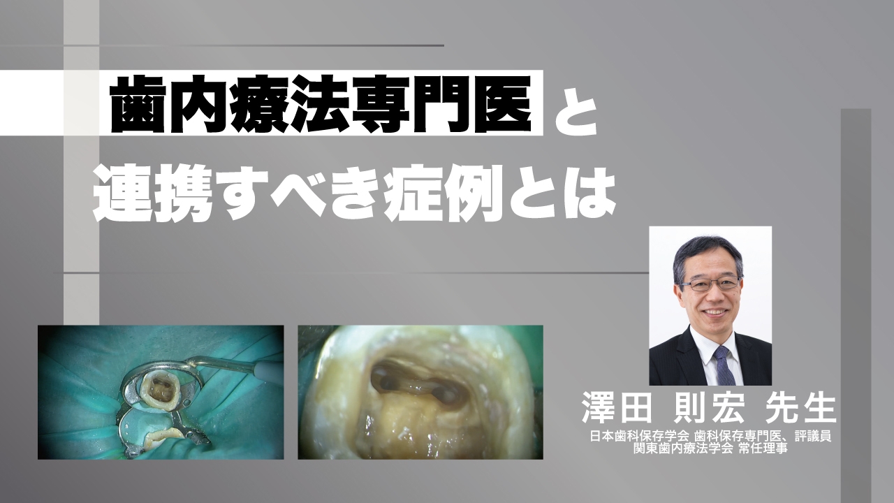 歯内療法専門医と連携すべき症例とはの画像です