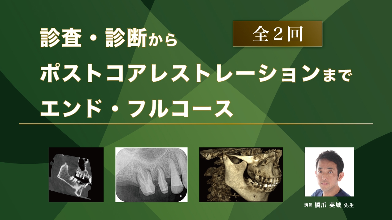 診査・診断からポストコアレストレーションまで エンド・フルコースの画像です