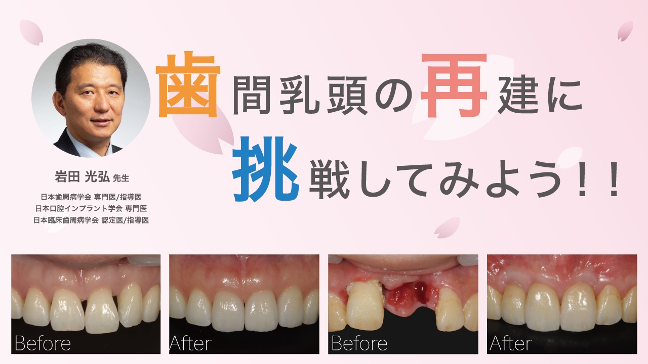 ☆販売日本☆ 歯科 再生療法(PRP) DVD - technicomm.qc.ca