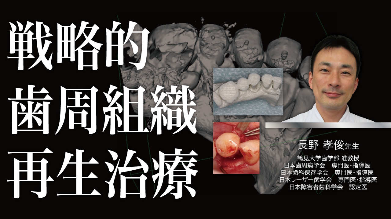 戦略的歯周組織再生治療〜CTデータと抗菌薬を応用する〜の画像です