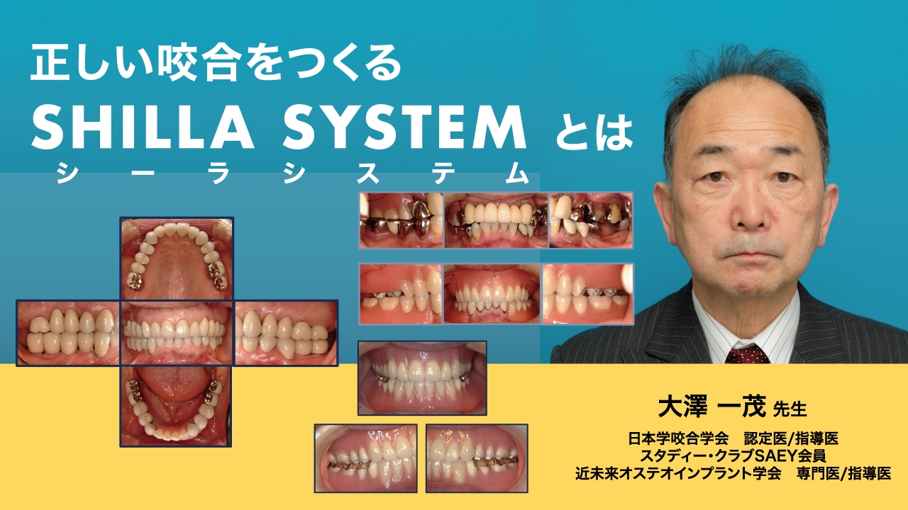 正しい咬合をつくるSHILLA SYSTEM(シーラシステム)とはの画像です