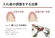 入れ歯の調整