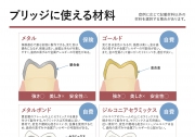 ブリッジに使える材料
