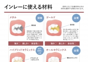インレーに使える材料
