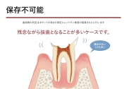 保存不可能