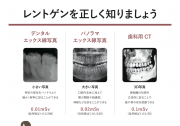 レントゲン安全性について①