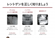 レントゲン安全性について①