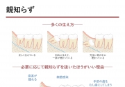 親知らず