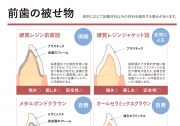 前歯の被せ物