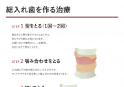 総入れ歯を作る治療