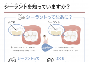 シーラントってなあに?