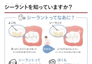 シーラントってなあに?