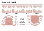 乳歯のむし歯の進行