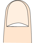 健康な爪