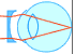 近視眼鏡の構造
