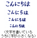 パーキンソン病