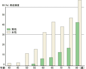 グラフ：年齢別にみた骨粗しょう症の発症頻度
