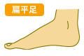 扁平足