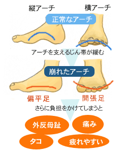 足のアーチ