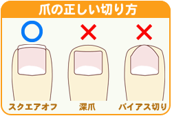 爪の正しい切り方