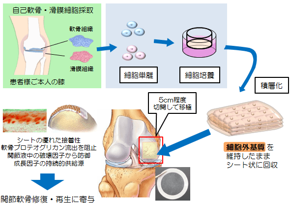図：細胞シート工学を応用した関節軟骨修復・再生
