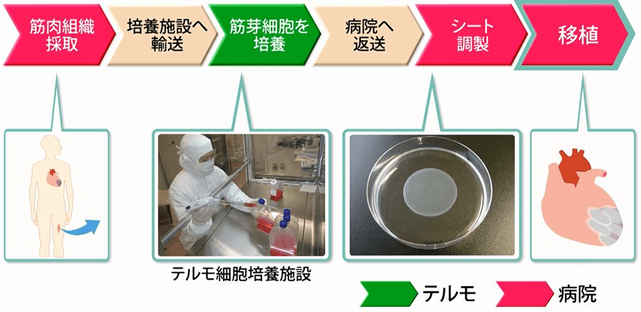 図：細胞シート治療の流れ