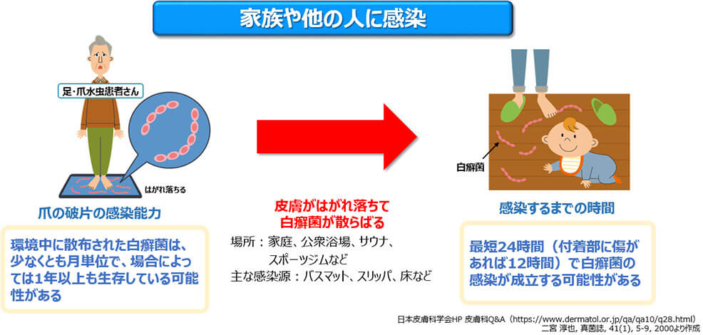図3：爪の水虫をほっておくとどうなる？