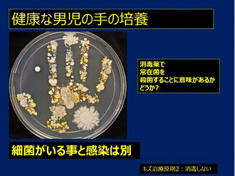 図：健康な男児の手の培養