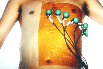 写真3：論文（文献1）に載っている「私の胸」