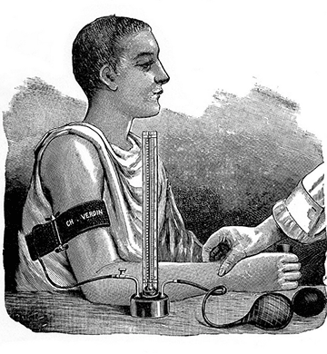 図1：リバロッチ法による血圧測定