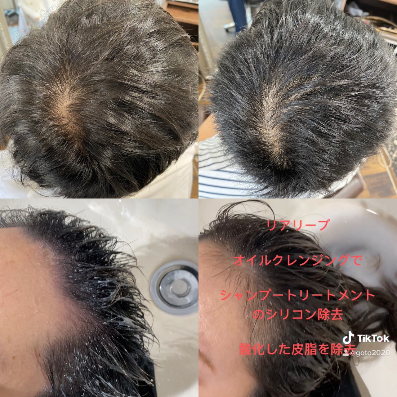 薄毛改善 ショート 頭皮改善 ベリーショート Aime エイ 557942 Hair