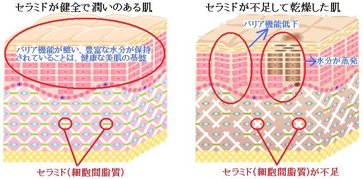 敏感肌レポート 基本編 セラミドって 何 敏感肌研究室 Arouge アルージェ