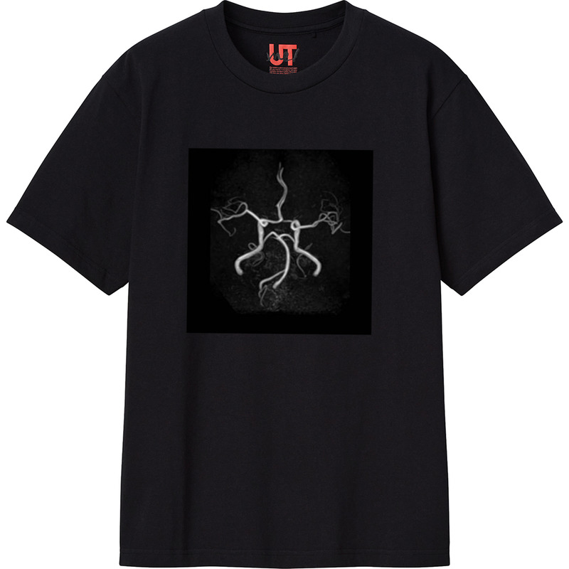 Aa3a55a2 6471 418a b0e0 6cf8c970339e 111 print ll