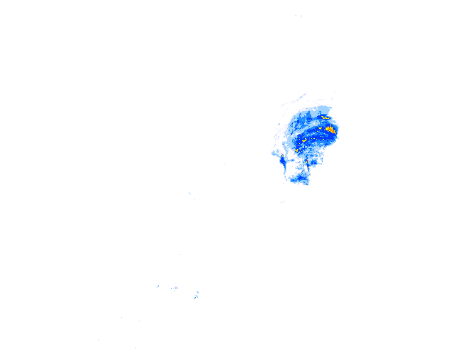 雨レーダー