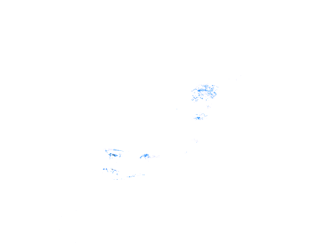 雨レーダー