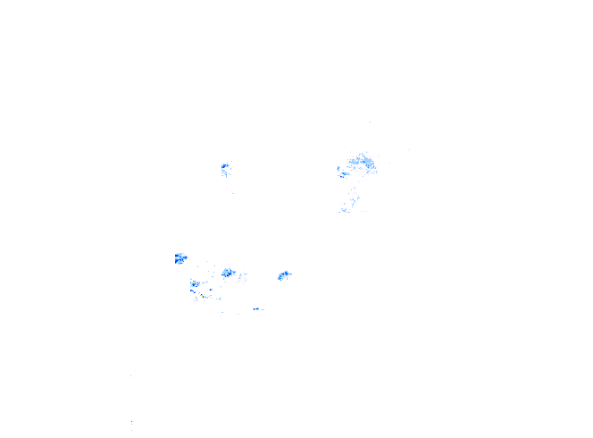 雨レーダー