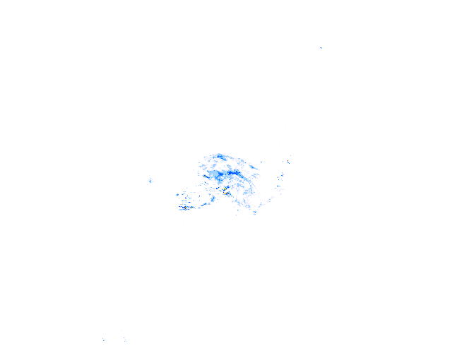 雨レーダー