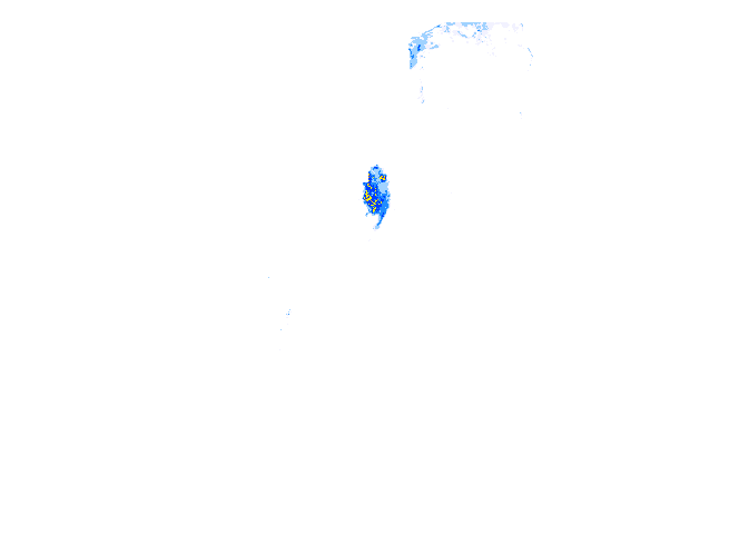 雨レーダー