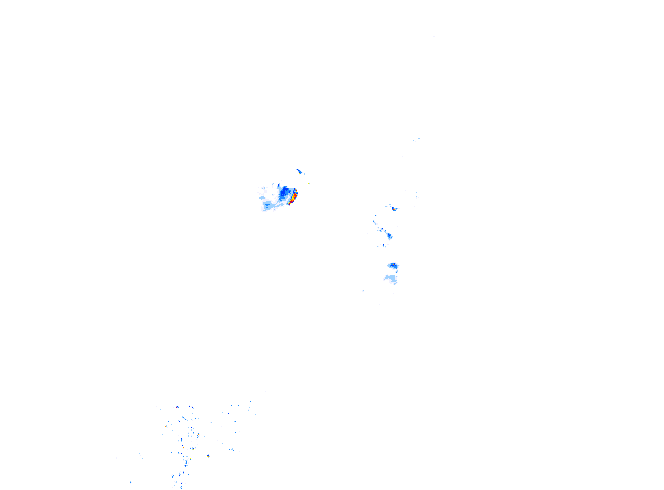 雨レーダー
