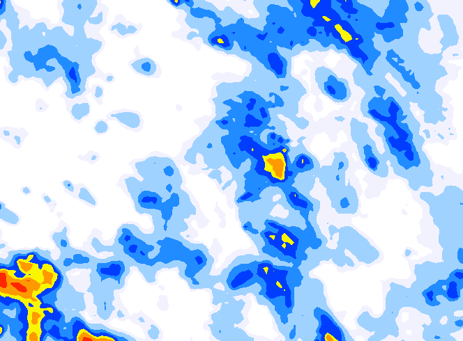 雨レーダー