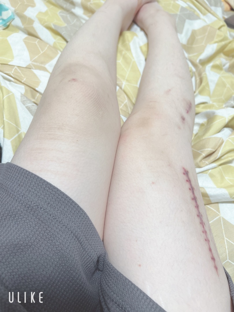 Thumb 23813a25 9b68 4689 8c21 f097f9ac25f8