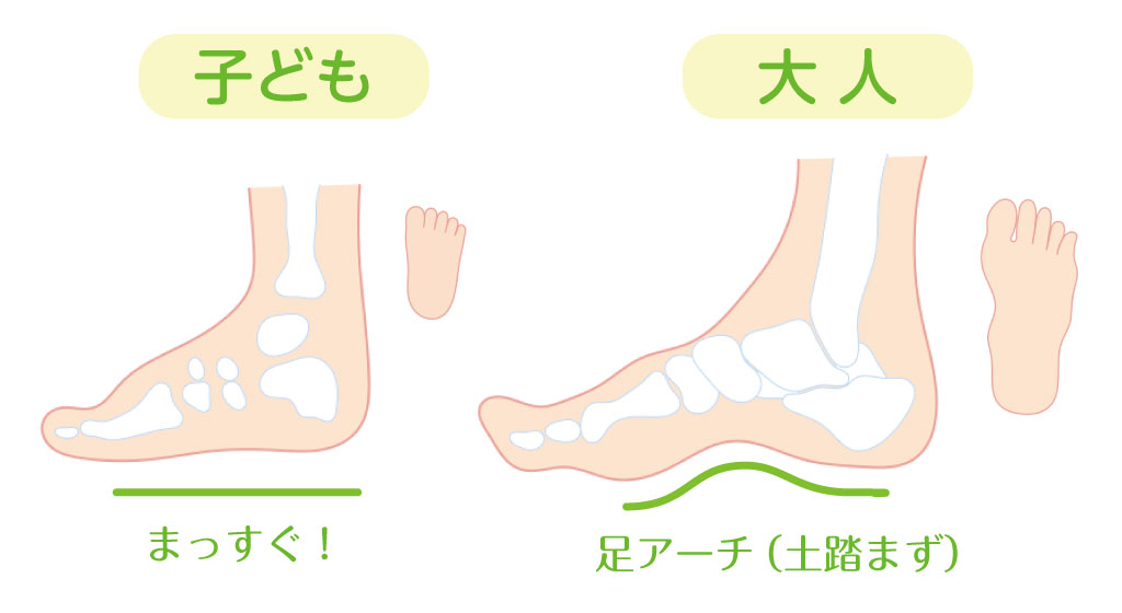 子どもはみんな扁平足!