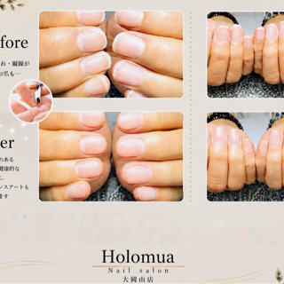coupon photo