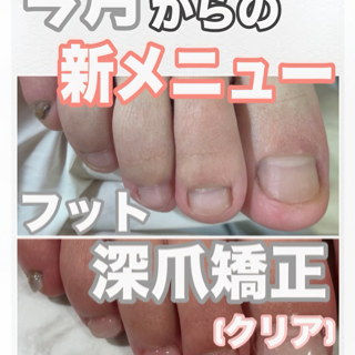 coupon photo