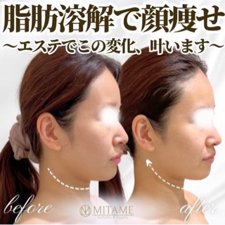 coupon photo