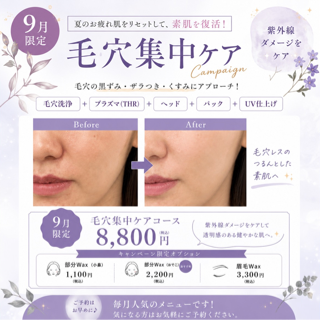 coupon photo