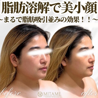 coupon photo