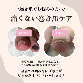 coupon photo