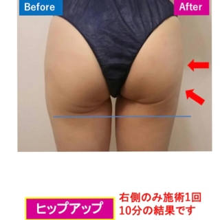 coupon photo