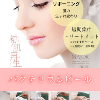 coupon photo